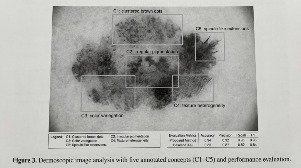 Dermoscopy image analysis illustrating five annotated concepts and their performance evaluation.